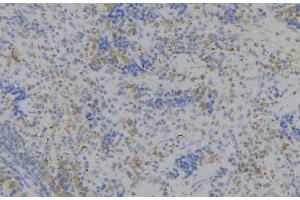 ABIN6279516 at 1/100 staining Human lymph node tissue by IHC-P. (LILRB2 anticorps)