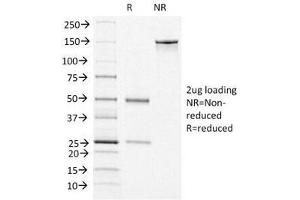 SDS-PAGE Analysis of Purified, BSA-Free vWF Antibody (clone VWF/1465).
