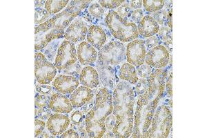 Immunohistochemistry of paraffin-embedded mouse kidney using AP2A1 Antibody (ABIN5975765) at dilution of 1/100 (40x lens). (alpha Adaptin anticorps)