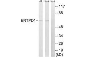 Western blot analysis of extracts from HeLa/Jurkat cells, using ENTPD1 Antibody.