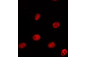 ABIN6275394 staining Hela by IF/ICC. (PRPF38A anticorps  (Internal Region))