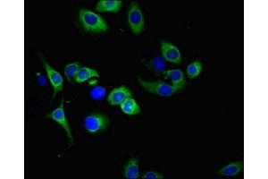 Immunofluorescent analysis of A549 cells using ABIN7173825 at dilution of 1:100 and Alexa Fluor 488-congugated AffiniPure Goat Anti-Rabbit IgG(H+L)