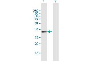 Western Blot analysis of BCAT1 expression in transfected 293T cell line by BCAT1 MaxPab polyclonal antibody. (BCAT1 anticorps  (AA 1-320))