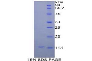 SDS-PAGE of Protein Standard from the Kit (Highly purified E. (IL-8 Kit CLIA)