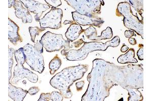IHC analysis of MUC1 using anti-MUC1 antibody .