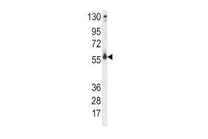 Western blot analysis of anti-CYP2C9 Antibody (Center) (ABIN392364 and ABIN2842002) in CEM cell line lysates (35 μg/lane).