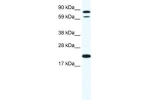 Western Blotting (WB) image for anti-Zinc Finger Protein 287 (ZNF287) antibody (ABIN2461531) (ZNF287 anticorps)