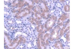 DAB staining on IHC-P; Samples: Mouse Kidney Tissue (MTF1 anticorps  (AA 2-139))