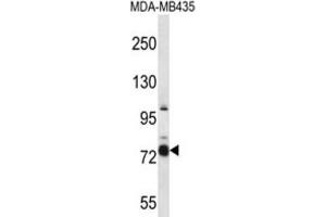 Western Blotting (WB) image for anti-Cas Scaffolding Protein Family Member 4 (CASS4) antibody (ABIN2997369) (CASS4 anticorps)