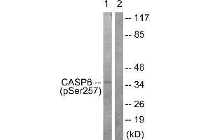 Immunohistochemistry analysis of paraffin-embedded human colon carcinoma tissue using Caspase 6 (Phospho-Ser257) antibody. (Caspase 6 anticorps  (pSer257))