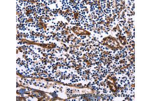 Immunohistochemistry of Human tonsil using DUSP6 Polyclonal Antibody at dilution of 1:25 (DUSP6 anticorps)