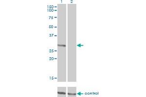 Western blot analysis of FCER1A over-expressed 293 cell line, cotransfected with FCER1A Validated Chimera RNAi (Lane 2) or non-transfected control (Lane 1). (Fc epsilon RI/FCER1A anticorps  (AA 1-257))