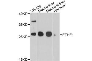 Western blot analysis of extracts of various cell lines, using ETHE1 antibody. (ETHE1 anticorps)