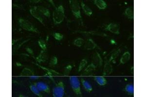 Immunofluorescence analysis of U-2 OS cells using GLUD1 Polyclonal Antibody at dilution of 1:100.