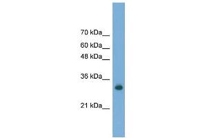 WB Suggested Anti-FAM78A Antibody Titration: 0.