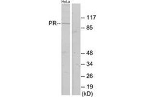 Western blot analysis of extracts from HeLa cells, using Progesterone Receptor (Ab-400) Antibody. (Progesterone Receptor anticorps  (AA 371-420))