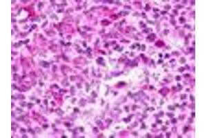 Anti-GPR183 / EBI2 antibody IHC of human lymph node. (GPR183 anticorps  (Cytoplasmic Domain))