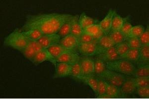 IF analysis of HMGB2 and Tubulin alpha using anti-HMGB2 antibody (ABIN4886620) and anti-Tubulin alpha antibody (ABIN7600339). (HMGB2 anticorps  (N-Term))
