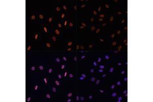 Immunofluorescence analysis of NIH/3T3 cells using Acetyl-Histone H2B-K12 antibody (ABIN7267731) at dilution of 1:100.