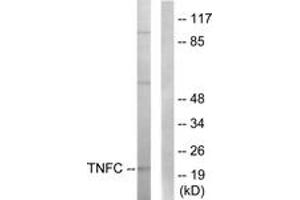Western blot analysis of extracts from HepG2 cells, using TNFC Antibody. (LTB anticorps  (AA 181-230))