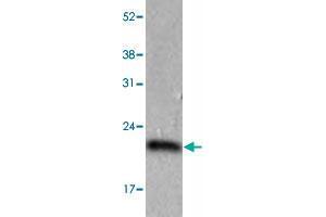 The HeLa (40 ug) were resolved by SDS-PAGE, transferred to PVDF membrane and probed with PPIC monoclonal antibody, clone AT3C6  (1:1000). (PPIC anticorps  (AA 39-197))
