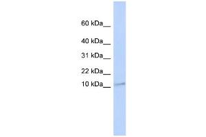 WB Suggested Anti-TMEM93 Antibody Titration:  0. (TMEM93 anticorps  (N-Term))