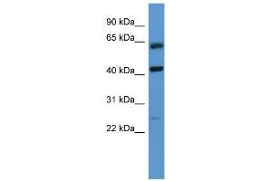 WB Suggested Anti-GPRC5B Antibody Titration: 0. (GPRC5B anticorps  (N-Term))