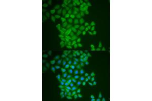 Immunofluorescence analysis of MCF-7 cell using FTH1 antibody.