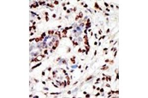 Image no. 1 for anti-Myeloid/lymphoid Or Mixed-Lineage Leukemia (MLL) (C-Term) antibody (ABIN356674) (MLL/KMT2A anticorps  (C-Term))