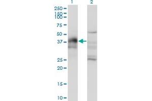 Western Blot analysis of DLX3 expression in transfected 293T cell line by DLX3 monoclonal antibody (M03), clone 3C3. (DLX3 anticorps  (AA 1-287))