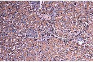 ABIN184575 (8µg/ml) staining of paraffin embedded Human Kidney. (SOCS1 anticorps  (C-Term))
