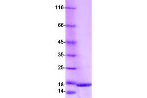 Validation with Western Blot