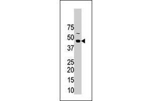 The STRADA polyclonal antibody  is used in Western blot to detect STRADA in mouse brain tissue lysate. (STRADA anticorps  (N-Term))
