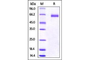 Mouse LAG-3, His Tag on SDS-PAGE under reducing (R) condition.