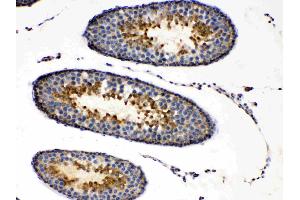 PRKAR1A was detected in paraffin-embedded sections of rat testis tissues using rabbit anti- PRKAR1A Antigen Affinity purified polyclonal antibody (Catalog # ) at 1 µg/mL.