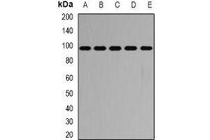 Western blot analysis of PYGB expression in SW620 (A), HT29 (B), mouse heart (C), mouse lung (D), rat brain (E) whole cell lysates. (PYGB anticorps)