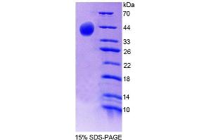 SDS-PAGE analysis of Mouse SYN2 Protein. (SYN2 Protéine)