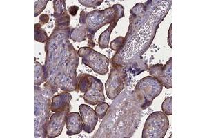 Immunohistochemical staining of human placenta with PLEKHG6 polyclonal antibody  shows strong membranous staining positivity in trophoblastic cells. (PLEKHG6 anticorps)