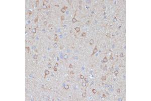 Immunohistochemistry of paraffin-embedded rat brain using COPG2 antibody (ABIN7266425) at dilution of 1:100 (40x lens). (COPG2 anticorps  (AA 542-871))