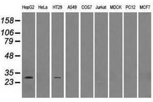 Image no. 2 for anti-Replication Protein A2, 32kDa (RPA2) antibody (ABIN1500734) (RPA2 anticorps)