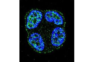 Confocal immunofluorescent analysis of SCUBE2 Antibody (Center ) (ABIN655409 and ABIN2844955) with ZR-75-1 cell followed by Alexa Fluor 488-conjugated goat anti-rabbit lgG (green). (SCUBE2 anticorps  (AA 251-280))