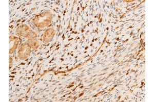 ABIN6267232 at 1/100 staining rat uterine tissue sections by IHC-P.