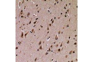 Immunohistochemical analysis of SFT2D3 staining in human brain formalin fixed paraffin embedded tissue section. (SFT2D3 anticorps)