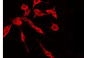ABIN6274845 staining Hela by IF/ICC. (TMEM237 anticorps  (Internal Region))