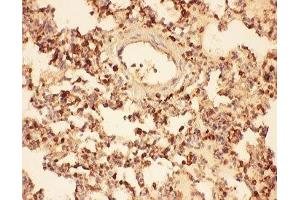 IHC-P testing of rat lung tissue (Cofilin anticorps  (AA 2-166))