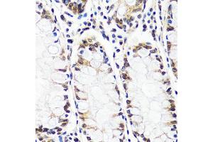 Immunohistochemistry of paraffin-embedded human colon using C antibody (ABIN7266546) at dilution of 1:100 (40x lens). (CAND1 anticorps  (AA 750-980))