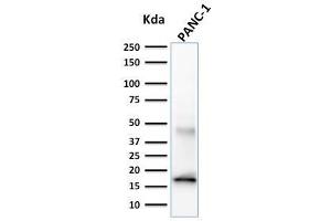Western Blot Analysis of PANC-1 cell lysate using CELA3B Mouse Monoclonal Antibody (CELA3B/1257). (Elastase 3B anticorps  (AA 82-238))