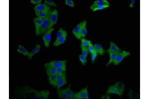Immunofluorescence staining of HepG2 cells with ABIN7169835 at 1:66, counter-stained with DAPI. (KCNN3 anticorps  (AA 240-426))