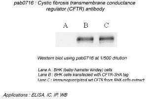 Image no. 2 for anti-Cystic Fibrosis Transmembrane Conductance Regulator (ATP-Binding Cassette Sub-Family C, Member 7) (CFTR) (N-Term) antibody (ABIN559718) (CFTR anticorps  (N-Term))