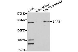 Immunoprecipitation analysis of 150ug extracts of Jurkat cells using 3ug SART1 antibody. (SART1 anticorps  (AA 1-255))